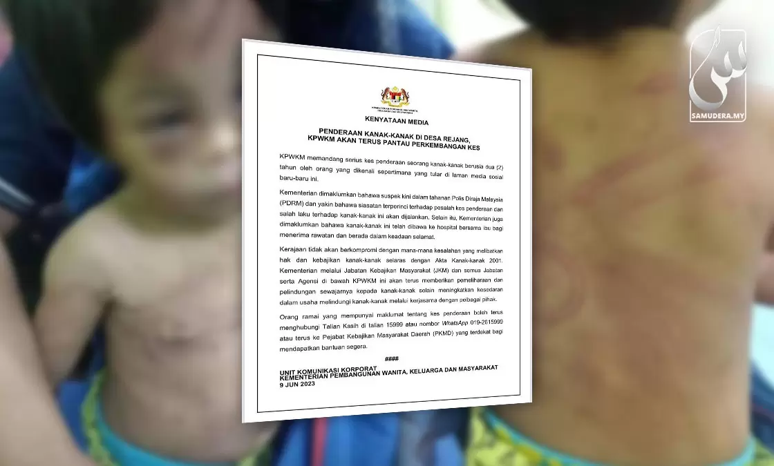 Dera-Kanak-Kanak-Kerajaan-Tidak-Akan-Berkompromi