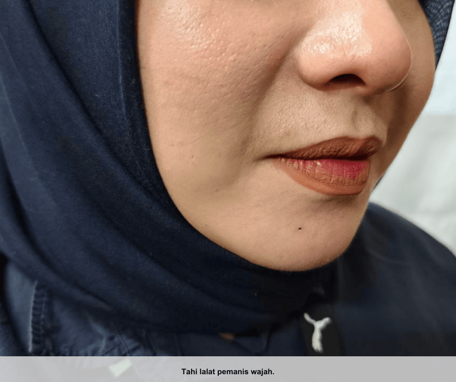 TAHI LALAT PETUNJUK KESIHATAN KULIT