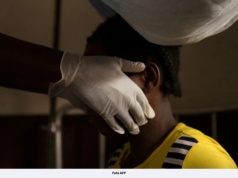 9 MAUT AKIBAT CACAR MONYET DI SINDH, PAKISTAN